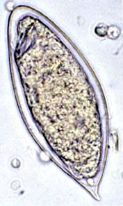Яйцо шистосомы (Schistosoma haematobium)